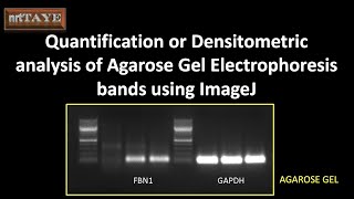 Quantification or densitometric analysis of agarose gel electrophoresis bands using ImageJ [upl. by Derfliw]