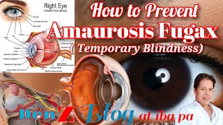 How to prevent Amaurosis Fugax or Temporary Blindness [upl. by Akemehs]