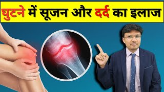 Joint InflammationTop Tips and Food Products to Reduce JOINT SWELLING [upl. by Yarg]