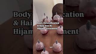 General detoxication amp Hair loss By Hijama Treatment arbicnaatringtone hijama [upl. by Adlar]