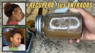 REMEDIO PARA HACER CRECER EL CABELLO DE LAS ENTRADAS Cómo Recuperar las Entradas mujeres y hombres [upl. by Aerdua]