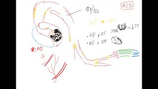 Interlinking pathophysiology part 3 heart failure lung edema pulmonary hypertension COPD OSA [upl. by Naerda]