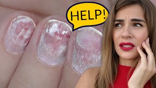 Can You Do Extensions on DAMAGED Nails It Depends [upl. by Glovsky210]