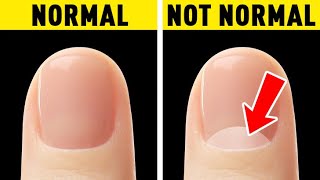 Your Nails Will Tell You More About Your Body Than You Might Think [upl. by Raval]