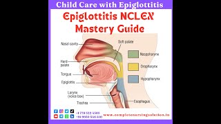 Epiglottitis For NCLEX epiglottitis education nursingexam nclexquestions nclexpreparation eaxm [upl. by Maddie]