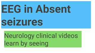 EEG in absent seizures [upl. by Aihsyla]