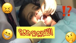 التقويم بوجع؟ 😬  😧Braces Pains [upl. by Eornom]