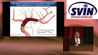 Future Stroke Thrombectomy Devices  Promise of Cyclical Aspiration [upl. by Iffar]