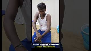 elbow dislocation treatment  முழங்கை மூட்டு விலகல்  vadapalani  puttur kattu [upl. by Ashely]