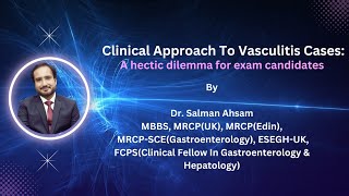 Clinical Approach To Vasculitis Cases In PACES examination A hectic dilemma for candidates [upl. by Tengler551]