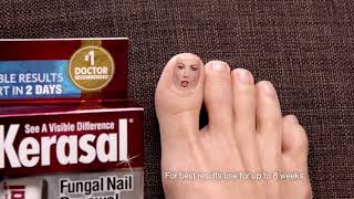 Kerasal® Fungal Nail Renewal™ Improves Appearance of Discolored or Damaged Nails [upl. by Auhoj]