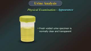 Urine Analysis [upl. by Onofredo]