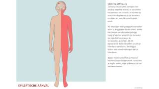 Epileptische aanval [upl. by Aihsem]