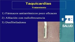 Tratamiento de las arritmias de taquicardia fármacos ablación y desfibrilador [upl. by Nancey]