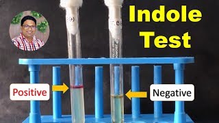 Bacterial Identification Tests Indole Test [upl. by Ellened]