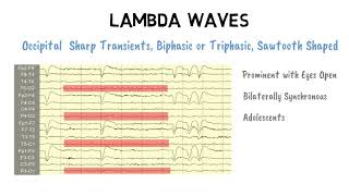 LAMBDA WAVES [upl. by Drewett]