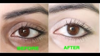 How to Remove Dark Circles Naturally in 3 Days 100 Results [upl. by Millhon]