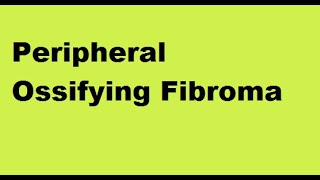 Peripheral Ossifying Fibroma [upl. by Luane]