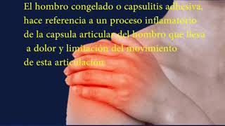 Hombro Congelado  Capsulitis Adhesiva [upl. by Vyky]