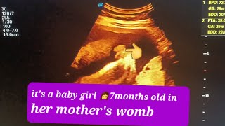 Baby girl 7months old in her mothers womb subscribe my channel for more video baby babygirl [upl. by Maher351]