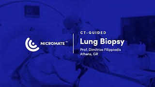 Micromate™  CTguided RoboticAssisted Lung Biopsy Prof Dimitrios Filippiadis [upl. by Arvad]