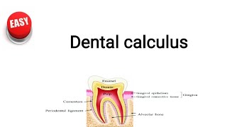 Dental calculus [upl. by Einahpehs245]