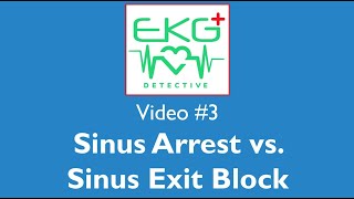 Video 3 Sinus Arrest vs Sinus Exit Block [upl. by Onailerua194]