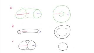 28 Introduction to Toric Lenses [upl. by Arhez879]