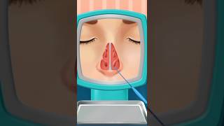 Blocked nose treatment [upl. by Leonerd]