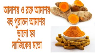 আমাশয় রোগের ঘরোয়া চিকিৎসা। dysentery home treatment [upl. by Eimas746]