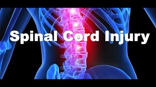 What is a spinal cord injury [upl. by Axe]