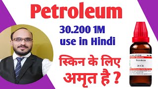 PETROLEUM 302001M Use in hindi  Petroleum 30 use  Petrolium Pomeopathic Medicine [upl. by Limoli340]