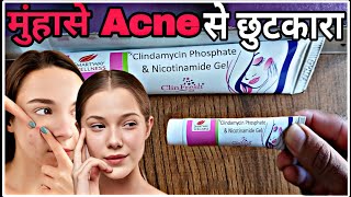 कील मुंहासे Acne की बेहतरीन gel 😱how to use clindamycin phosphate gel usp clindamycin skincare [upl. by Enilecram]