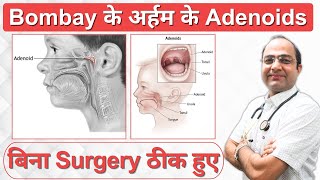 Adenoids Treatment Without Surgery  Symptoms of Adenoids  Adenoids Homeopathy Treatment in Jodhpur [upl. by Roberta]