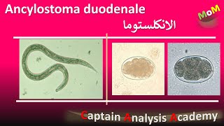 Ancylostoma duodenale  Hookworm الديدان الخطافية واذاى بتسبب انيميا نقص الحديد [upl. by Orman]