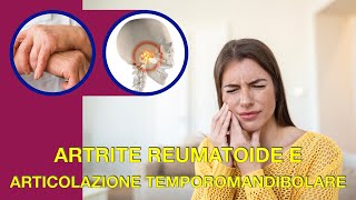 Artrite reumatoide e articolazione temporomandibolare [upl. by Ferwerda59]