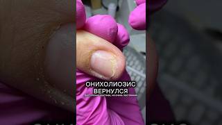 ЧТО ЖЕ НАМ ДЕЛАТЬ аленалаврентьева nails shortsvideo ногти маникюр подолог подология [upl. by Aernda]