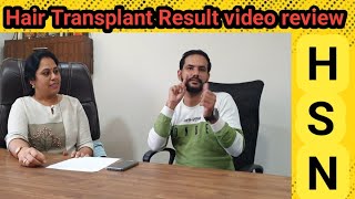 HSN Hair transplant result Happily reviewed by patient  hsn beforeandafter haircarespecialist [upl. by Wolff19]