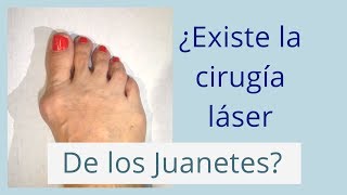 ¿EXISTE LA CIRUGÍA LASER DE JUANETES [upl. by Enaasiali]