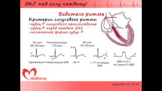 Урок 3 Видеокурс quotЭКГ под силу каждомуquot [upl. by Gottuard]