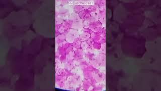 Squamous epithelial cells microscope slide🔬shortvideo youtube [upl. by Moises]