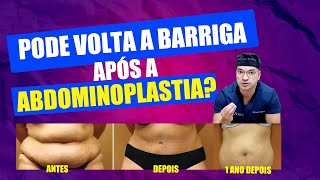 QUEM FAZ ABDOMINOPLASTIA PODE VOLTAR A TER BARRIGA I Cirurgia Plástica [upl. by Tannenbaum]