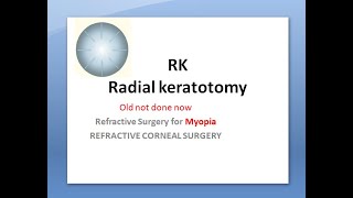 Ophthalmology 052 a Radial Keratotomy RK Myopia Surgery Corneal Disadvantages [upl. by Yedsnil347]