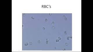 Microscopic Urinalysis [upl. by Camila]