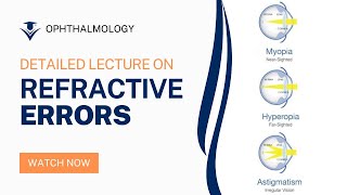 Understanding Refractive Errors in Ophthalmology A Comprehensive Lecture [upl. by Juliette]