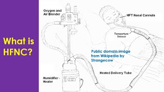 What is HFNC [upl. by Kwang]