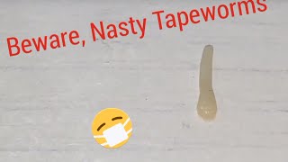 REAL MOVING TAPEWORM informative Video [upl. by Groark]