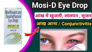 MosiD Eye Drops  Mosi D Eye drops use in Hindi  Pink Eyes  Conjunctivitis  आंख आना  Drops [upl. by Virendra]