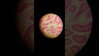 TS of Testis biology shorts practical experiment [upl. by Trimble]