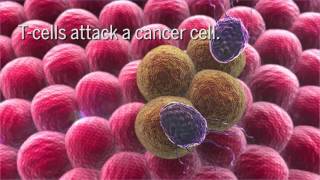 I Survived Stage IV Melanoma How Immunotherapy Saved My Life Mind Body Health com Video 2 [upl. by Yziar591]